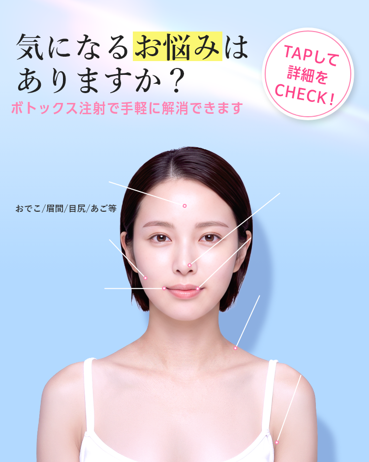 気になるお悩みはありますか？ ボトックス注射で手軽に解消できます