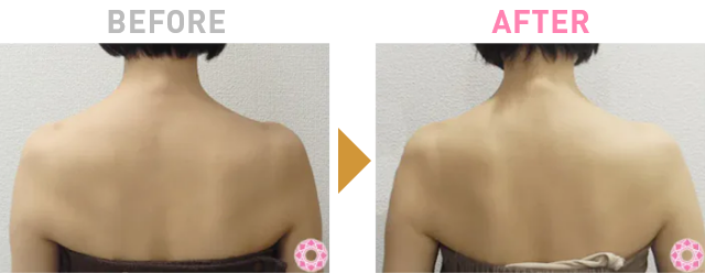 Before After 1